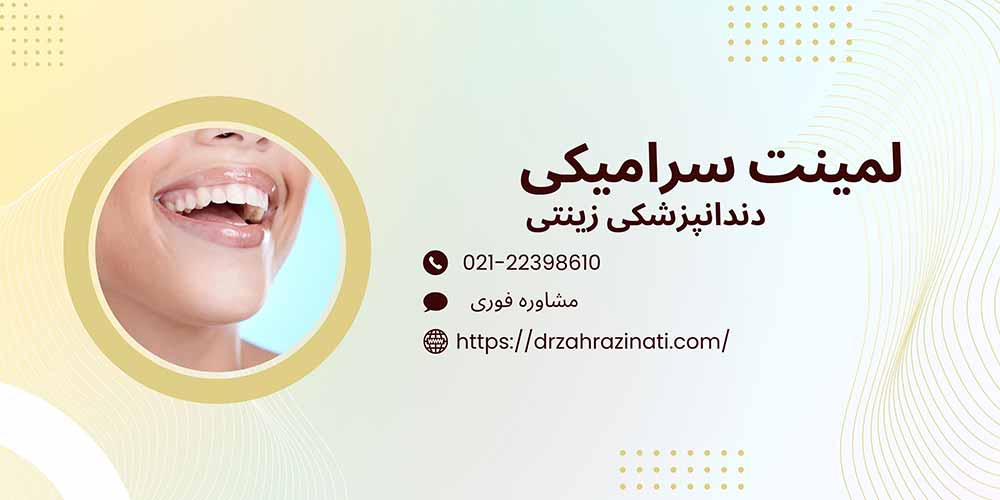 خدمات لمینت سرامیکی