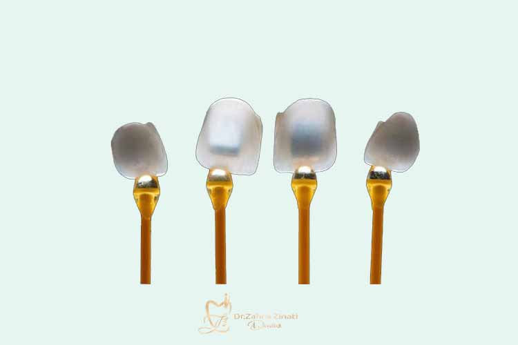 فواید لمینت سرامیکی