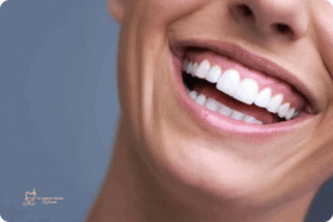 اصلاح دندانهای خرگوشی