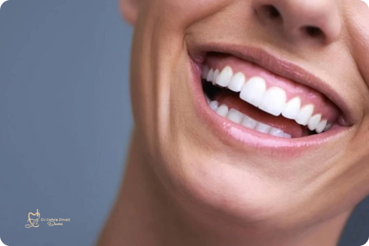 اصلاح دندانهای خرگوشی