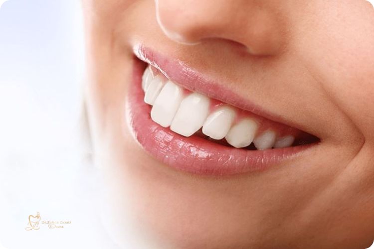دندانهای خرگوشی