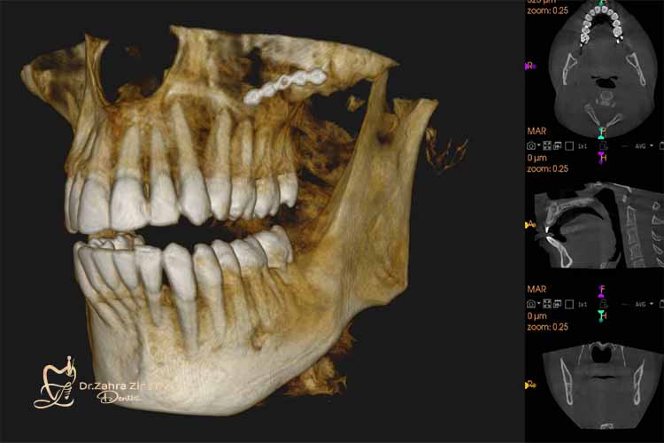 عکس دندان cbct