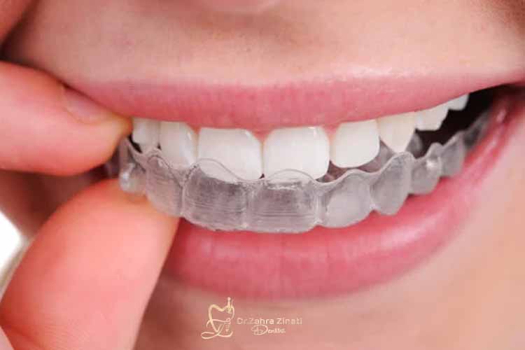 طریقه استفاده از نایت گارد 