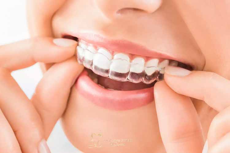 نایت گارد