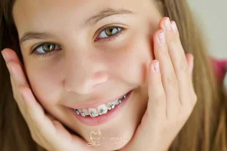 بهترین سن برای شروع ارتودنسی
