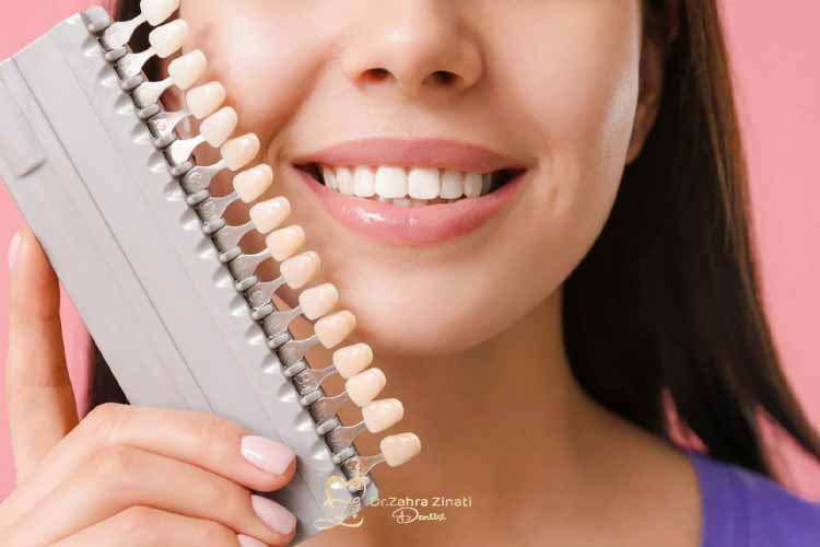 نگهداری ونیر دندان