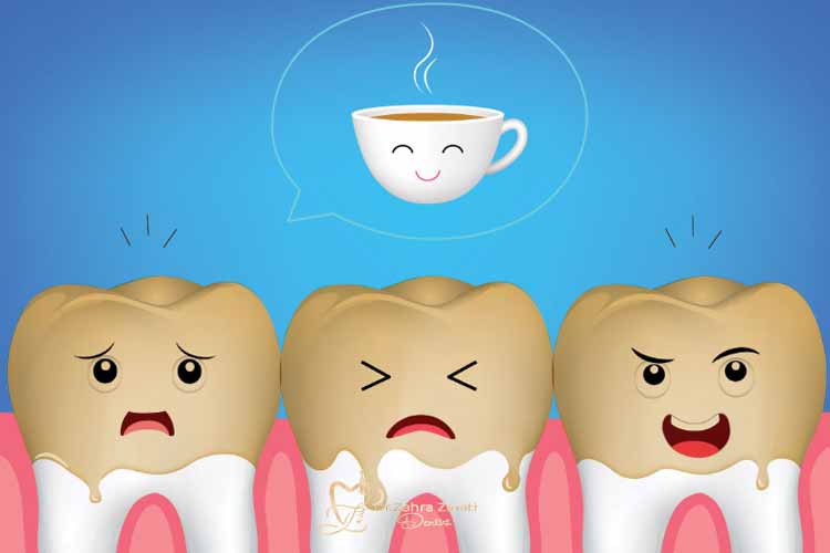 تاثیر قهوه، چای و نوشابه بر رنگ دندان 