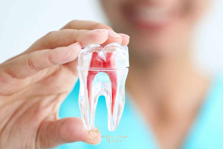 علت درد عصب کشی