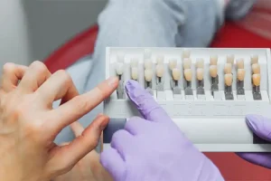 مقایسه انواع ساختار ذرات کامپوزیت دندان